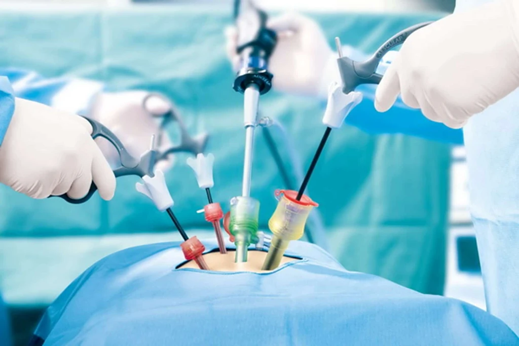 Laparoscopic Surgery Team
